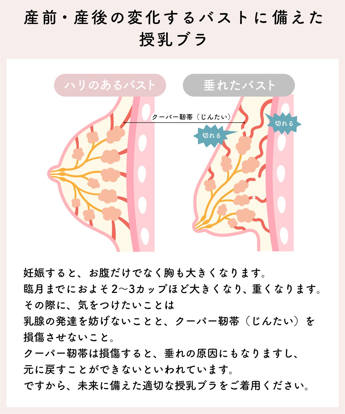 Rosemadame 【美妊婦】マタニティ授乳ブラ　ハーフトップ〔ノンワイヤー、クロスオープンタイプ〕（マタニティ/授乳服）入院準備 出産準備 産前 産後_sub_18